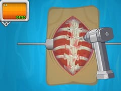 Operate Now: Scoliosis Surgery
