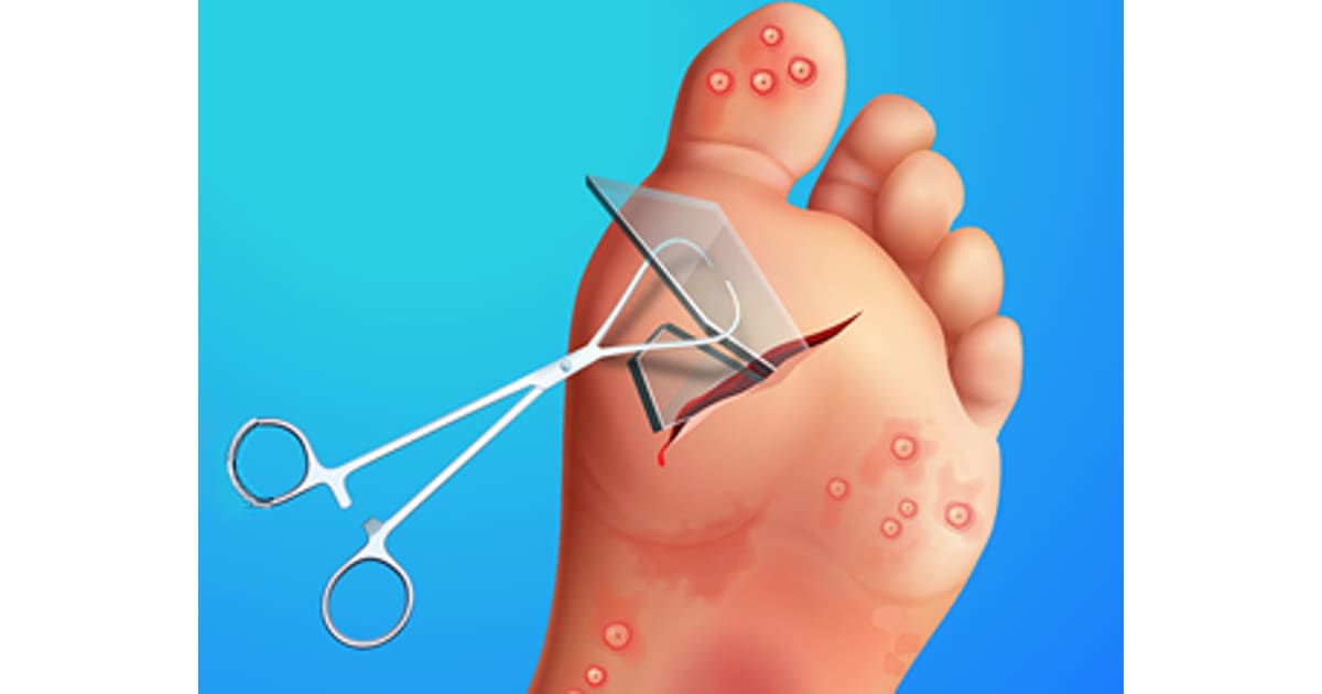 Foot Doctor Play Foot Doctor Online